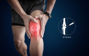 PRP Therapy for the Knee Featured Image