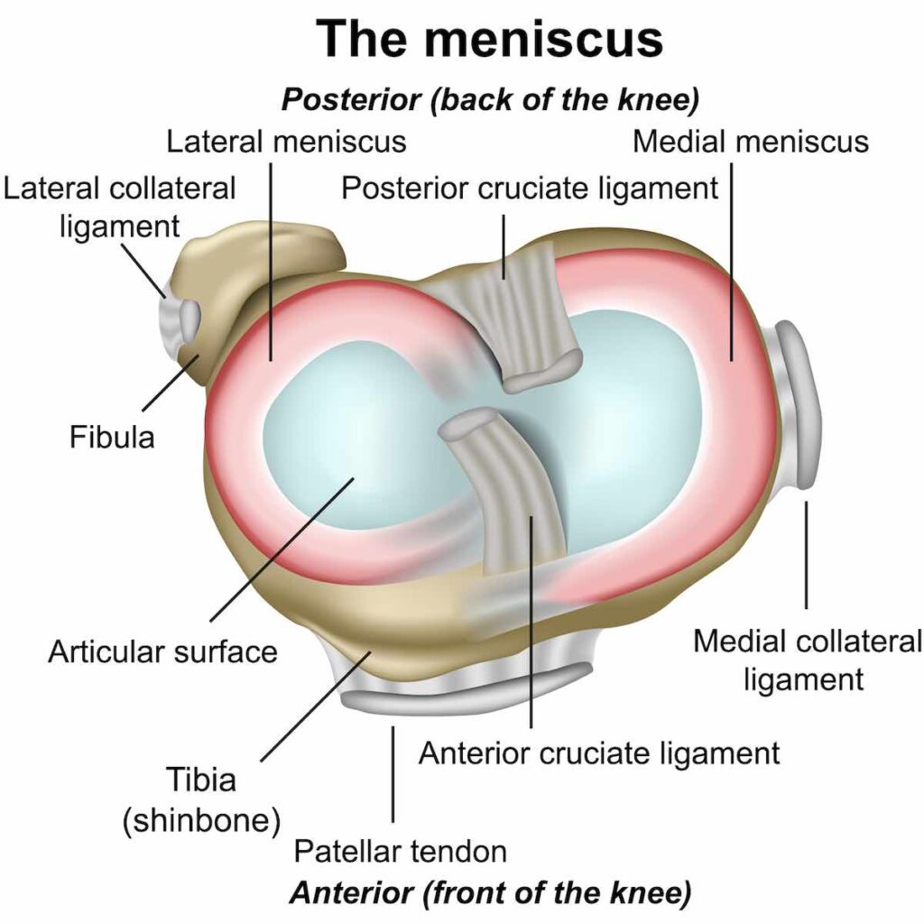 Illustration with callouts of the meniscus