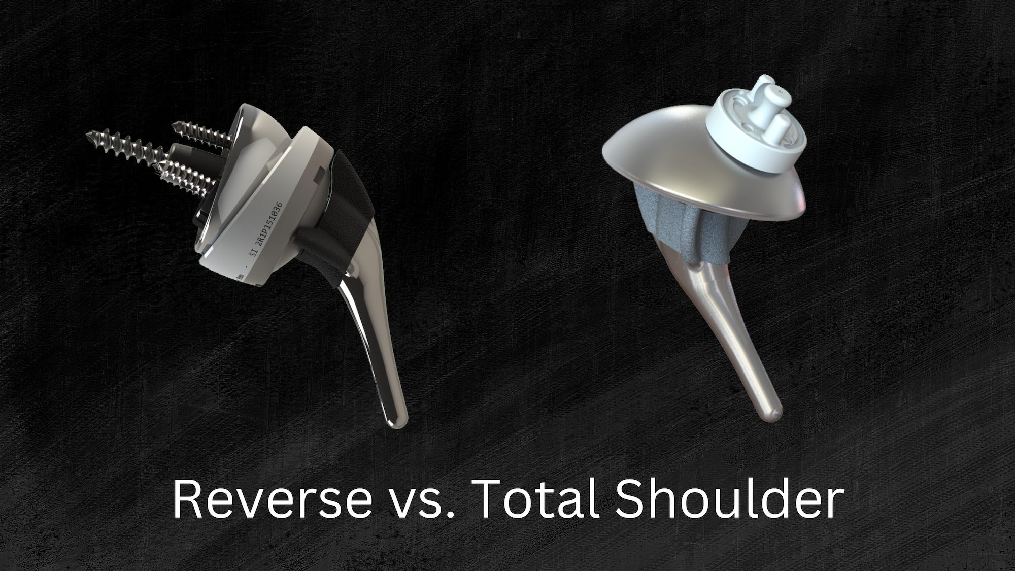 Reverse Total Shoulder vs. Total Shoulder
