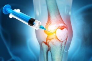 Knee injury being treated with stem cell therapy